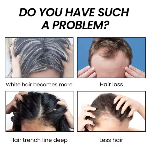 HUE Black Bamboo Charcoal Shampoo Bar - Picture 3 of 7